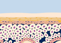 Microdermabrasion Klapp Cosmetics Microdermabrasion Klapp Cosmetics